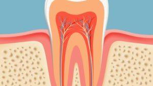 Root Canals