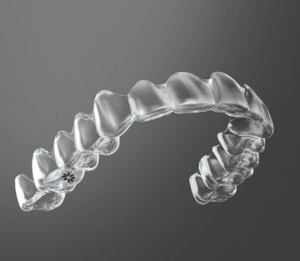 Invisalign clear braces